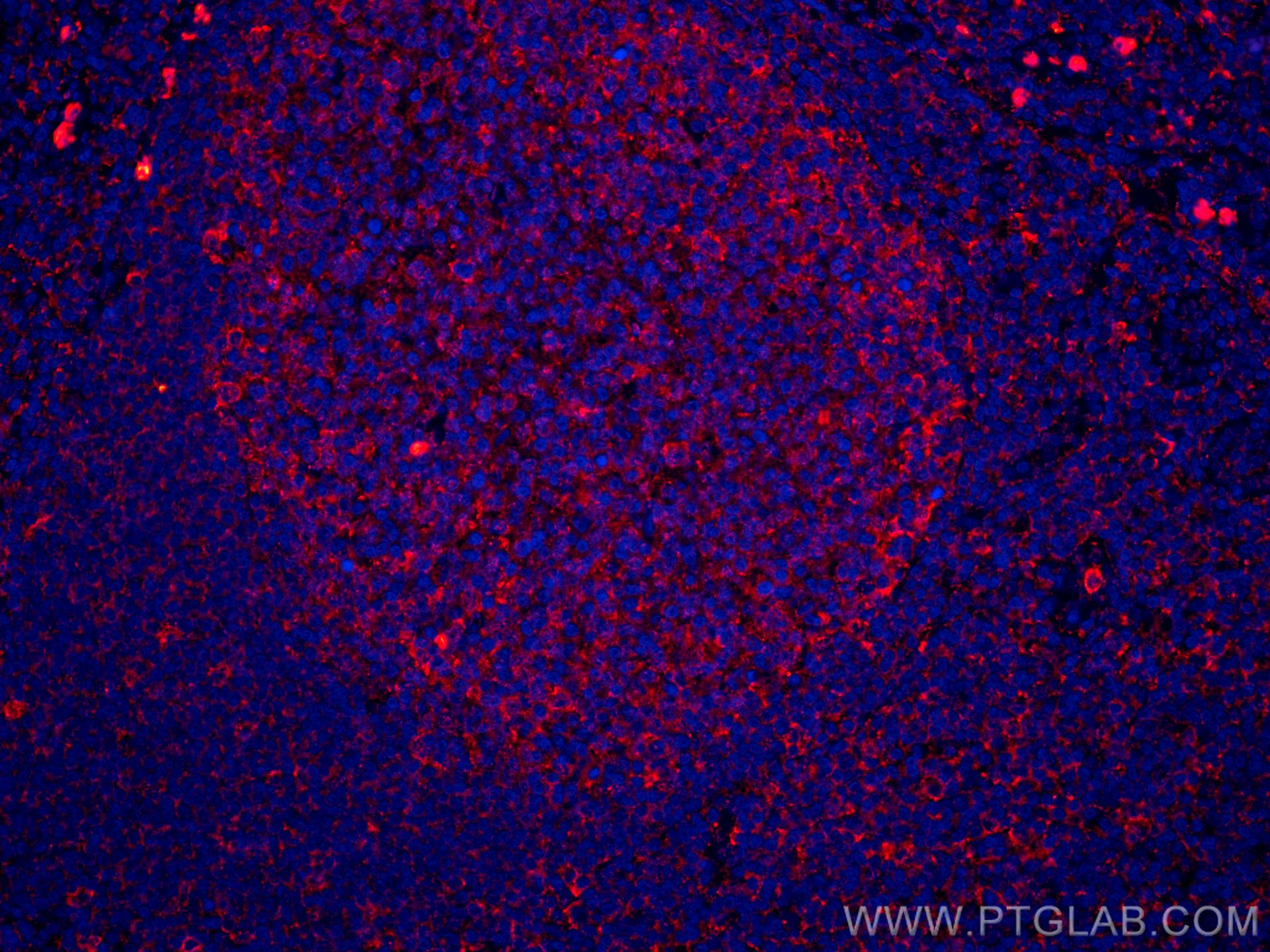 Immunofluorescence (IF) / fluorescent staining of human tonsillitis tissue using CoraLite®594-conjugated IL-36 Beta/IL-1F8 Monoclon (CL594-60290)