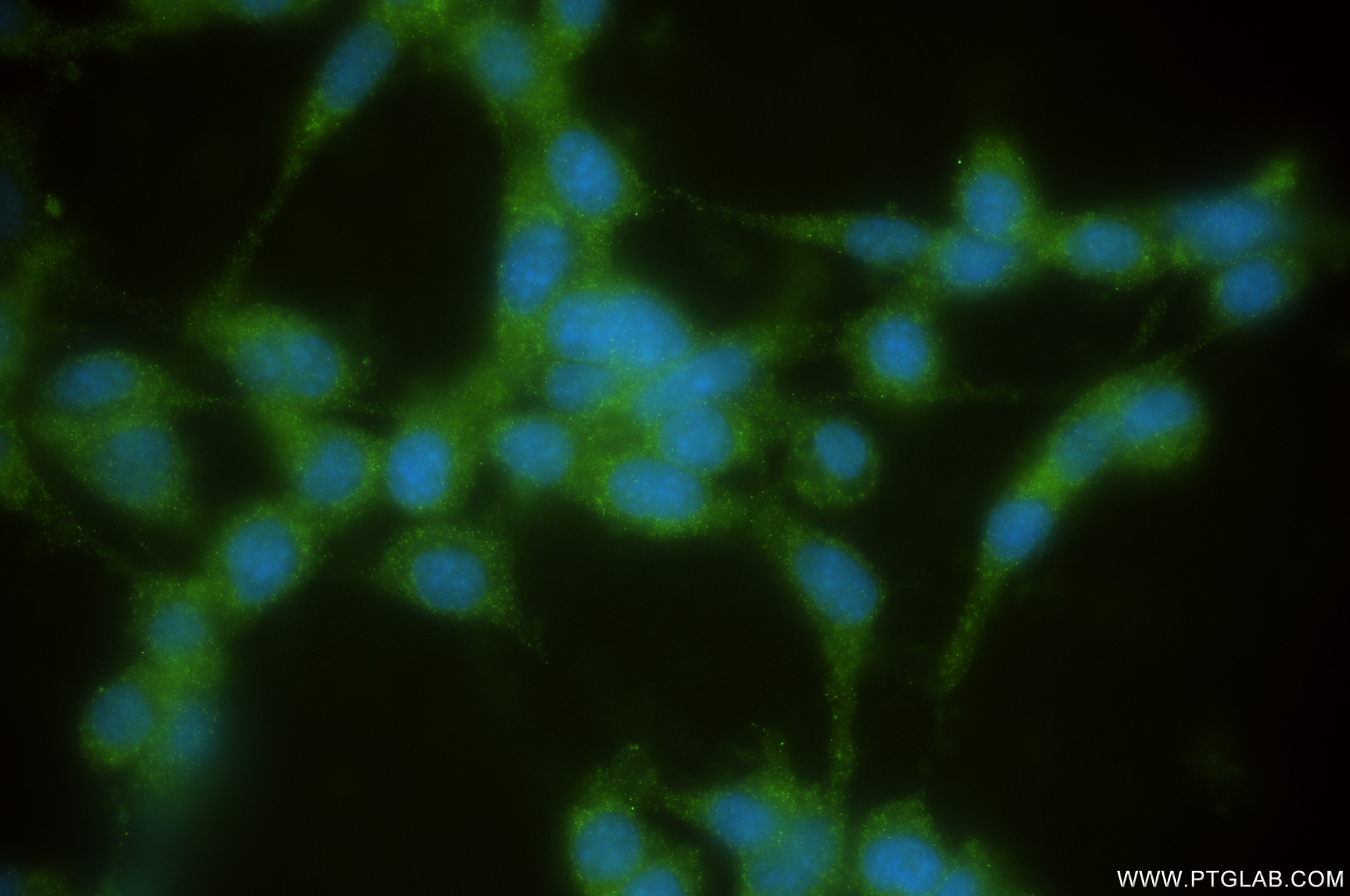 Immunofluorescence (IF) / fluorescent staining of NIH/3T3 cells using IL-4 Recombinant antibody (85179-5-RR)