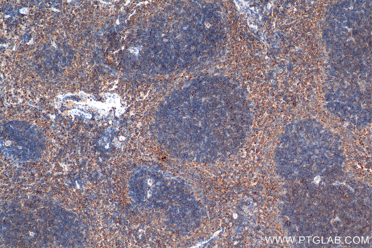 Immunohistochemical analysis of paraffin-embedded mouse spleen tissue slide using 84758-5-RR (IL-4RA/CD124 antibody) at dilution of 1:1000 (under 10x lens). Heat mediated antigen retrieval with Tris-EDTA buffer (pH 9.0). This data was developed using the same antibody clone with 84758-5-PBS in a different storage buffer formulation. Immunohistochemistry (IHC) staining of mouse spleen tissue using IL-4RA/CD124 Recombinant monoclonal antibody (84758-5-RR)