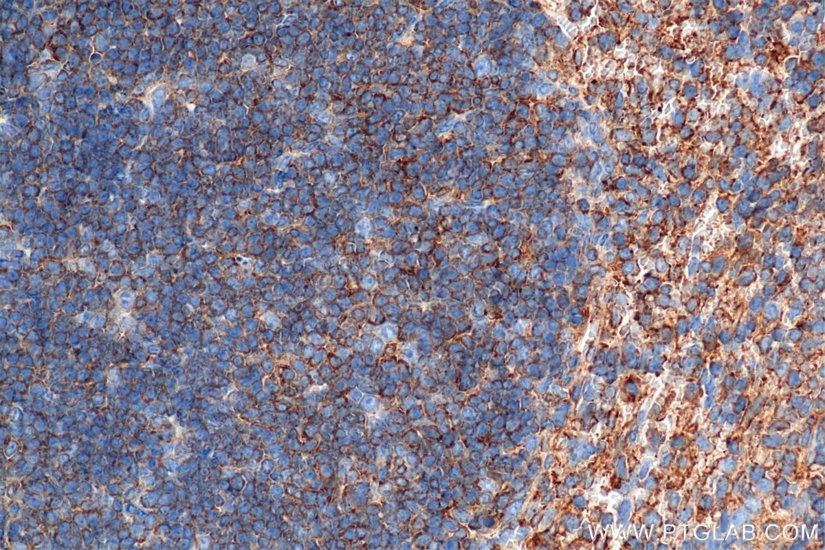 Immunohistochemical analysis of paraffin-embedded mouse spleen tissue slide using 84758-5-RR (IL-4RA/CD124 antibody) at dilution of 1:1000 (under 40x lens). Heat mediated antigen retrieval with Tris-EDTA buffer (pH 9.0). This data was developed using the same antibody clone with 84758-5-PBS in a different storage buffer formulation. Immunohistochemistry (IHC) staining of mouse spleen tissue using IL-4RA/CD124 Recombinant monoclonal antibody (84758-5-RR)
