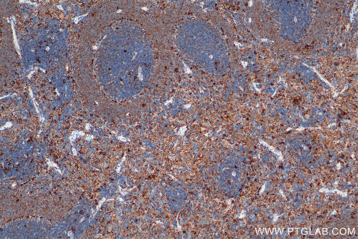 Immunohistochemical analysis of paraffin-embedded rat spleen tissue slide using 84758-5-RR (IL-4RA/CD124 antibody) at dilution of 1:1000 (under 10x lens). Heat mediated antigen retrieval with Tris-EDTA buffer (pH 9.0). This data was developed using the same antibody clone with 84758-5-PBS in a different storage buffer formulation. Immunohistochemistry (IHC) staining of rat spleen tissue using IL-4RA/CD124 Recombinant monoclonal antibody (84758-5-RR)