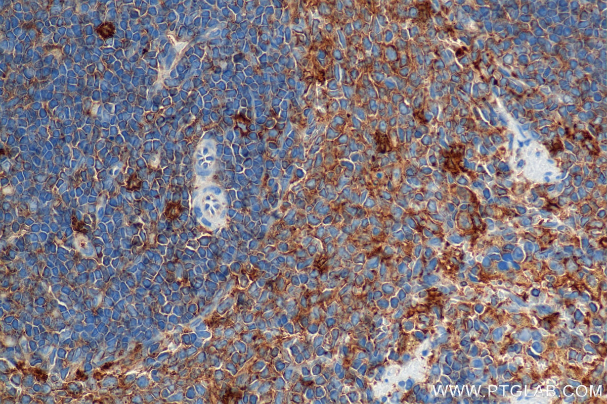 Immunohistochemical analysis of paraffin-embedded rat spleen tissue slide using 84758-5-RR (IL-4RA/CD124 antibody) at dilution of 1:1000 (under 40x lens). Heat mediated antigen retrieval with Tris-EDTA buffer (pH 9.0). This data was developed using the same antibody clone with 84758-5-PBS in a different storage buffer formulation. Immunohistochemistry (IHC) staining of rat spleen tissue using IL-4RA/CD124 Recombinant monoclonal antibody (84758-5-RR)