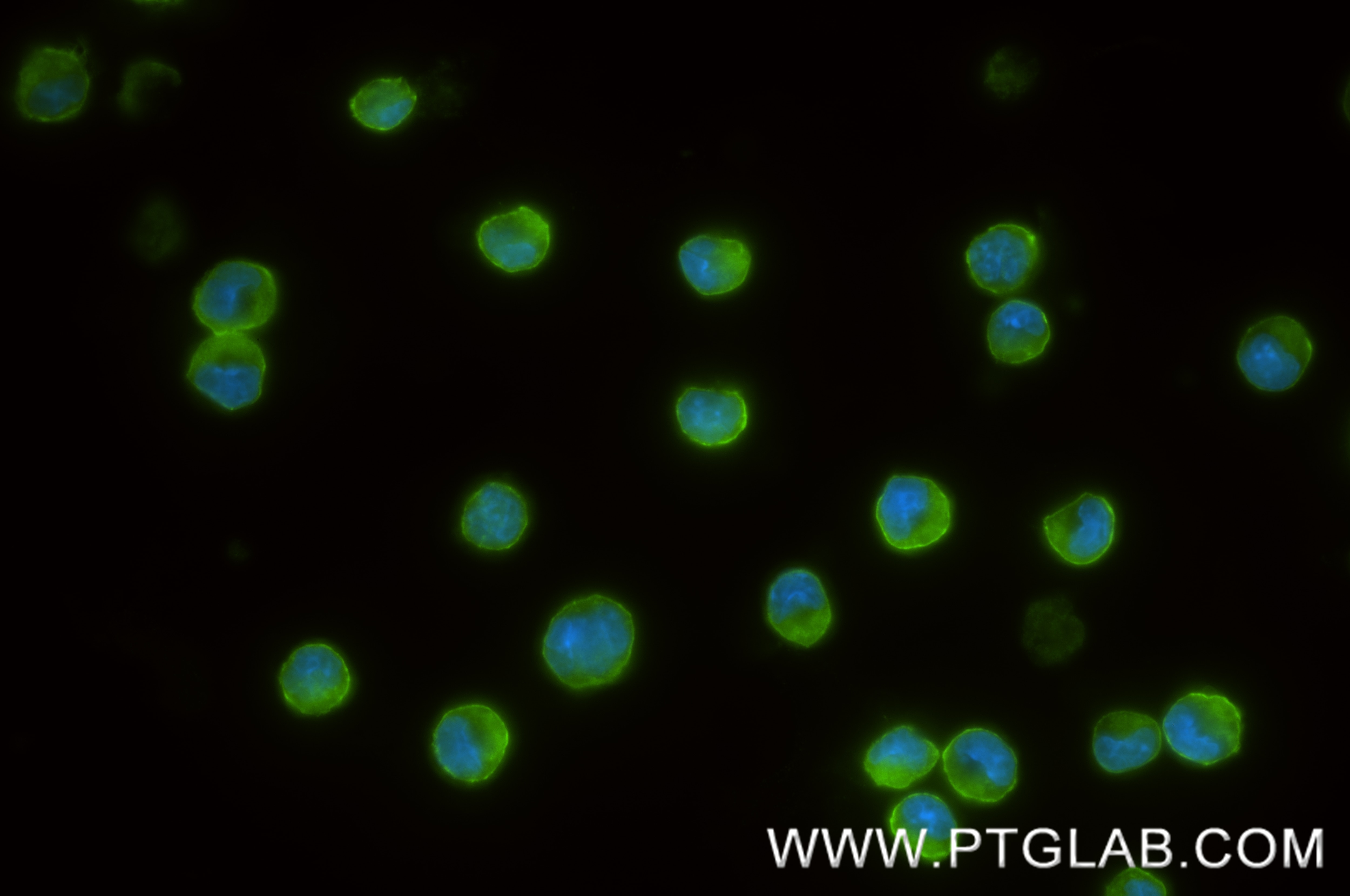 IF Staining of MC/9 using 84948-5-RR (same clone as 84948-5-PBS) Immunofluorescence (IF) / fluorescent staining of MC/9 cells using IL-5RA/CD125 Recombinant monoclonal antibody (84948-5-RR)