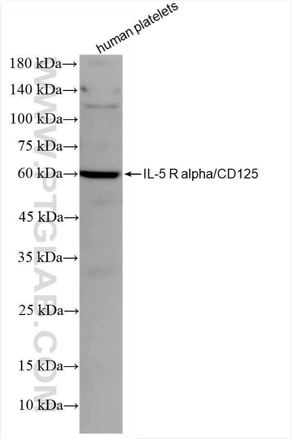 Western Blot (WB) analysis of human peripheral blood platelets using IL-5RA/CD125 Recombinant antibody (84948-5-RR)