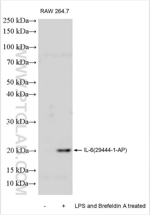 Western Blot (WB) analysis of various lysates using IL-6 Polyclonal antibody (29444-1-AP)