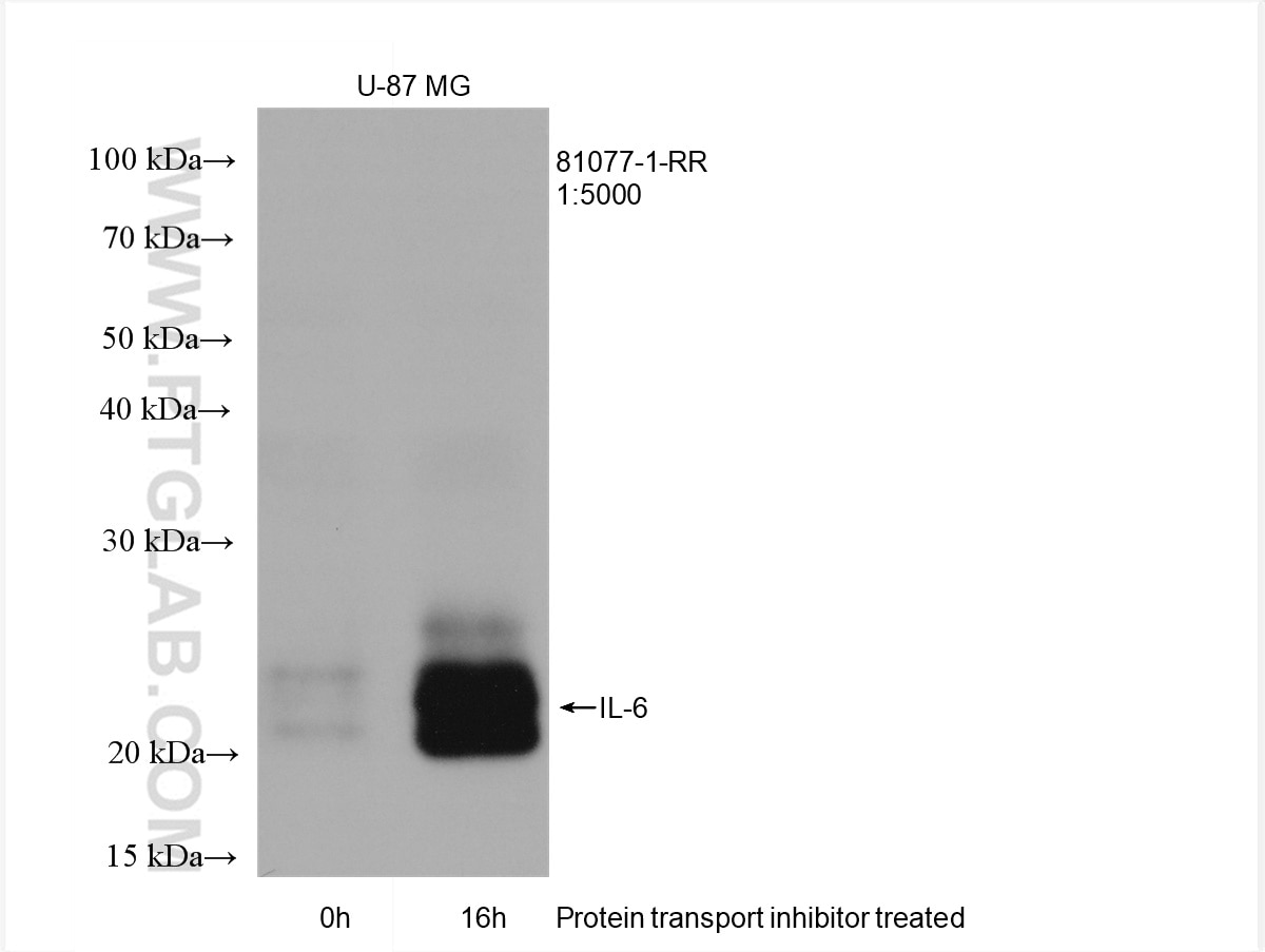 Western Blot (WB) analysis of U-87 MG cells using IL-6 Recombinant antibody (81077-1-RR)