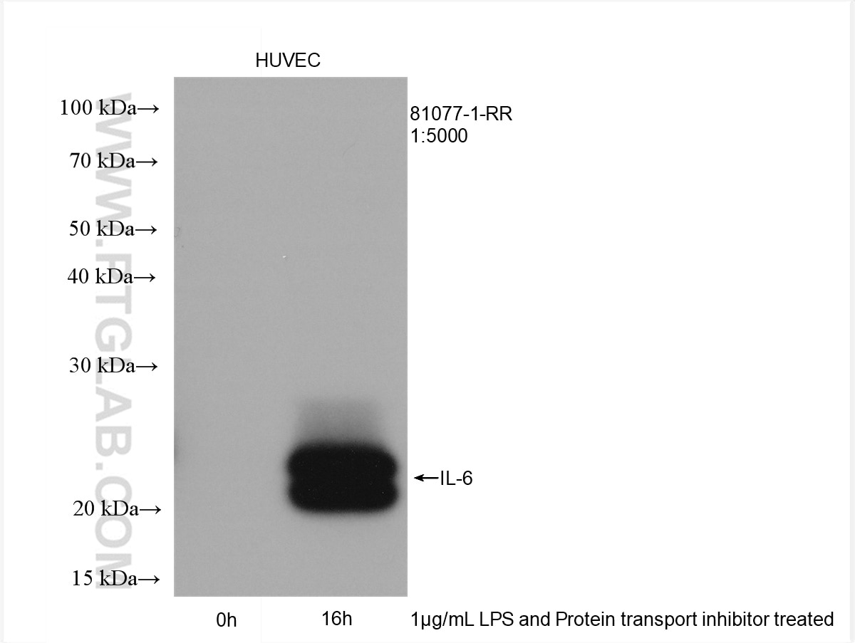 Western Blot (WB) analysis of HUVEC cells using IL-6 Recombinant antibody (81077-1-RR)