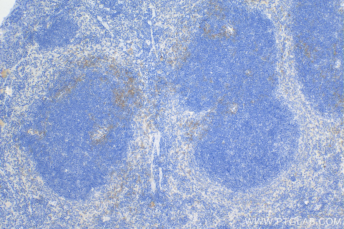 Immunohistochemistry (IHC) staining of mouse spleen tissue using IL-6 Recombinant antibody (83795-7-RR)