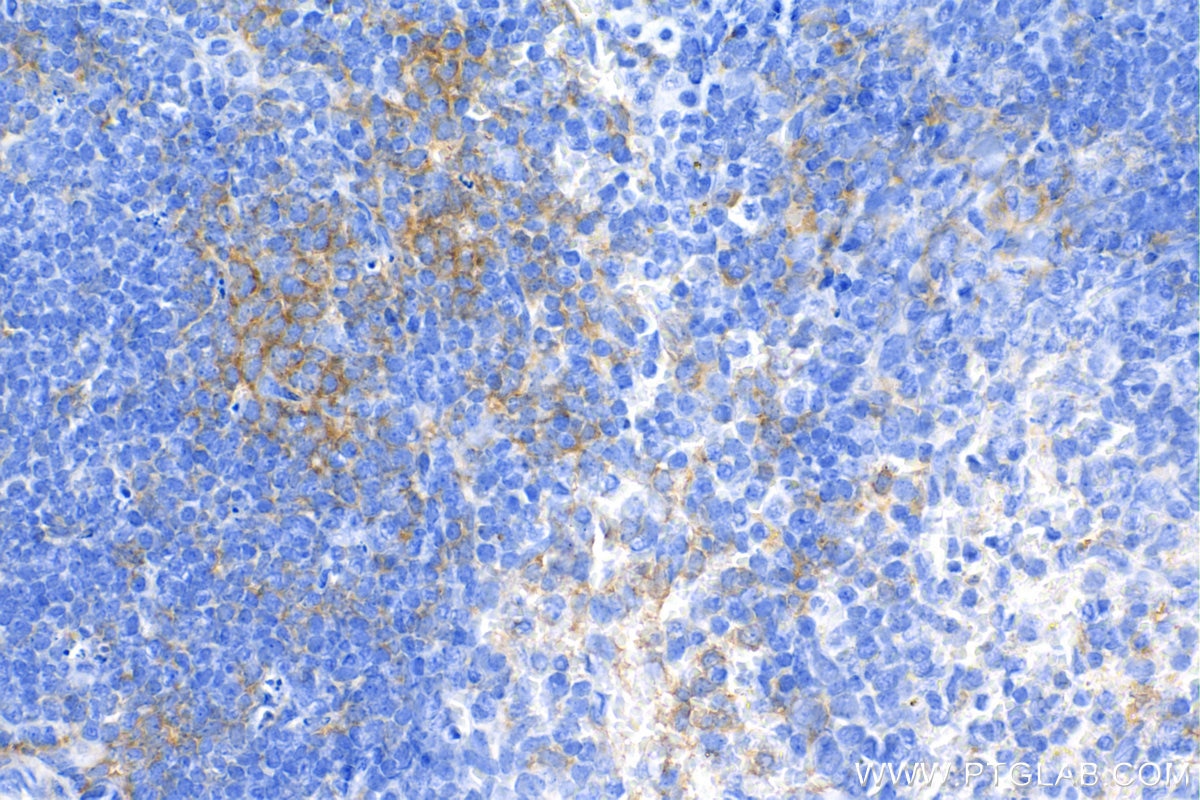 Immunohistochemistry (IHC) staining of mouse spleen tissue using IL-6 Recombinant antibody (83795-7-RR)