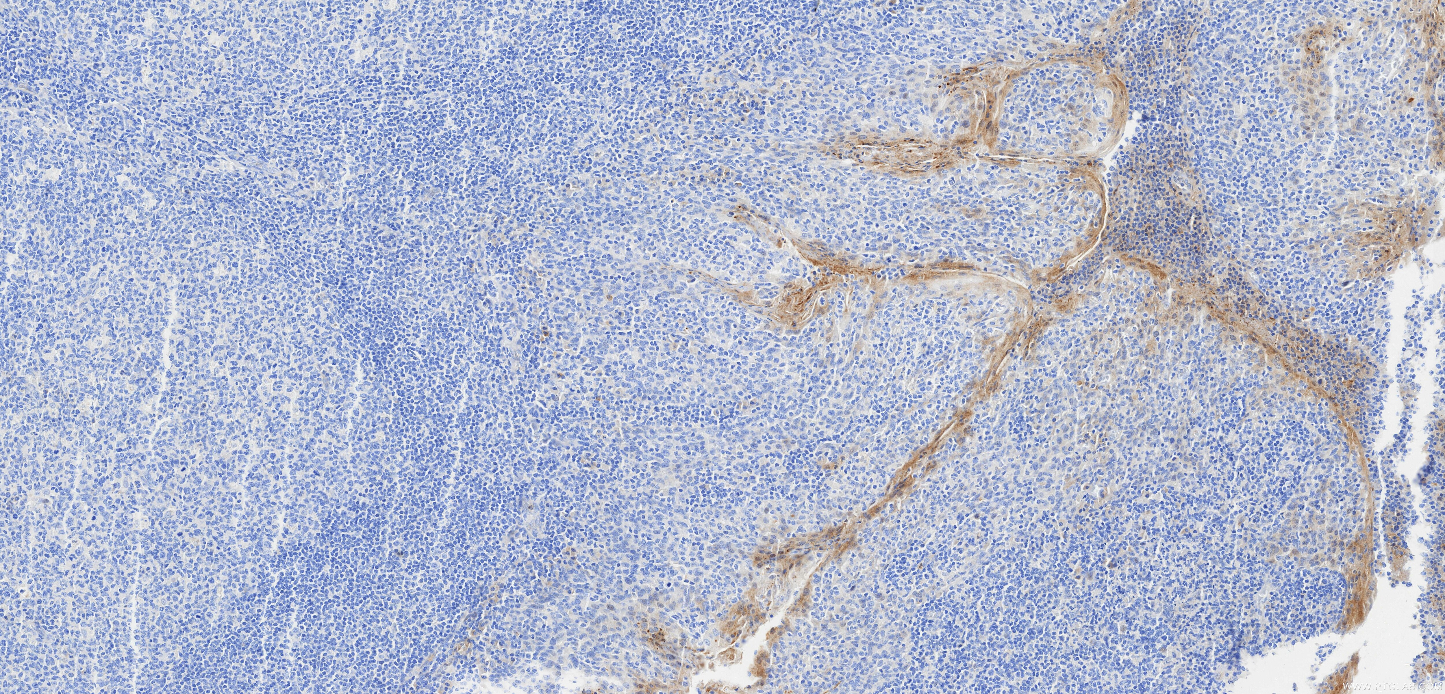 IHC staining of human tonsil using 98206-10-RR Immunohistochemistry (IHC) staining of human tonsil tissue using Anti-Human IL-7 Rabbit Recombinant Antibody (98206-10-RR)