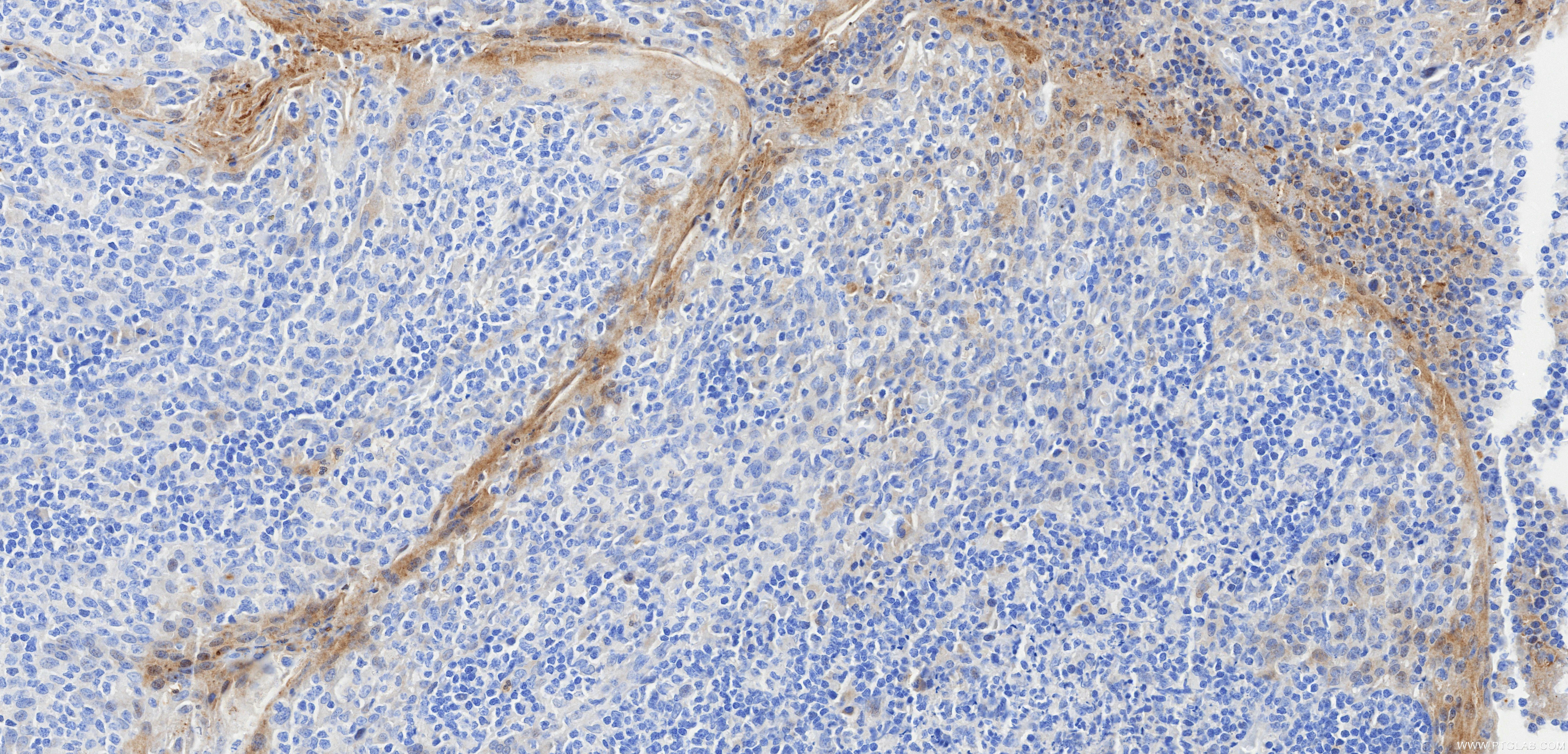 IHC staining of human tonsil using 98206-10-RR Immunohistochemistry (IHC) staining of human tonsil tissue using Anti-Human IL-7 Rabbit Recombinant Antibody (98206-10-RR)