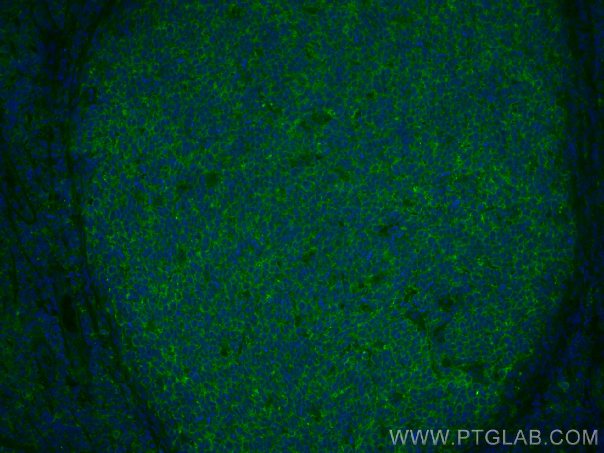 Immunofluorescence (IF) / fluorescent staining of human tonsillitis tissue using CoraLite® Plus 488-conjugated IL-9 Monoclonal anti (CL488-66144)