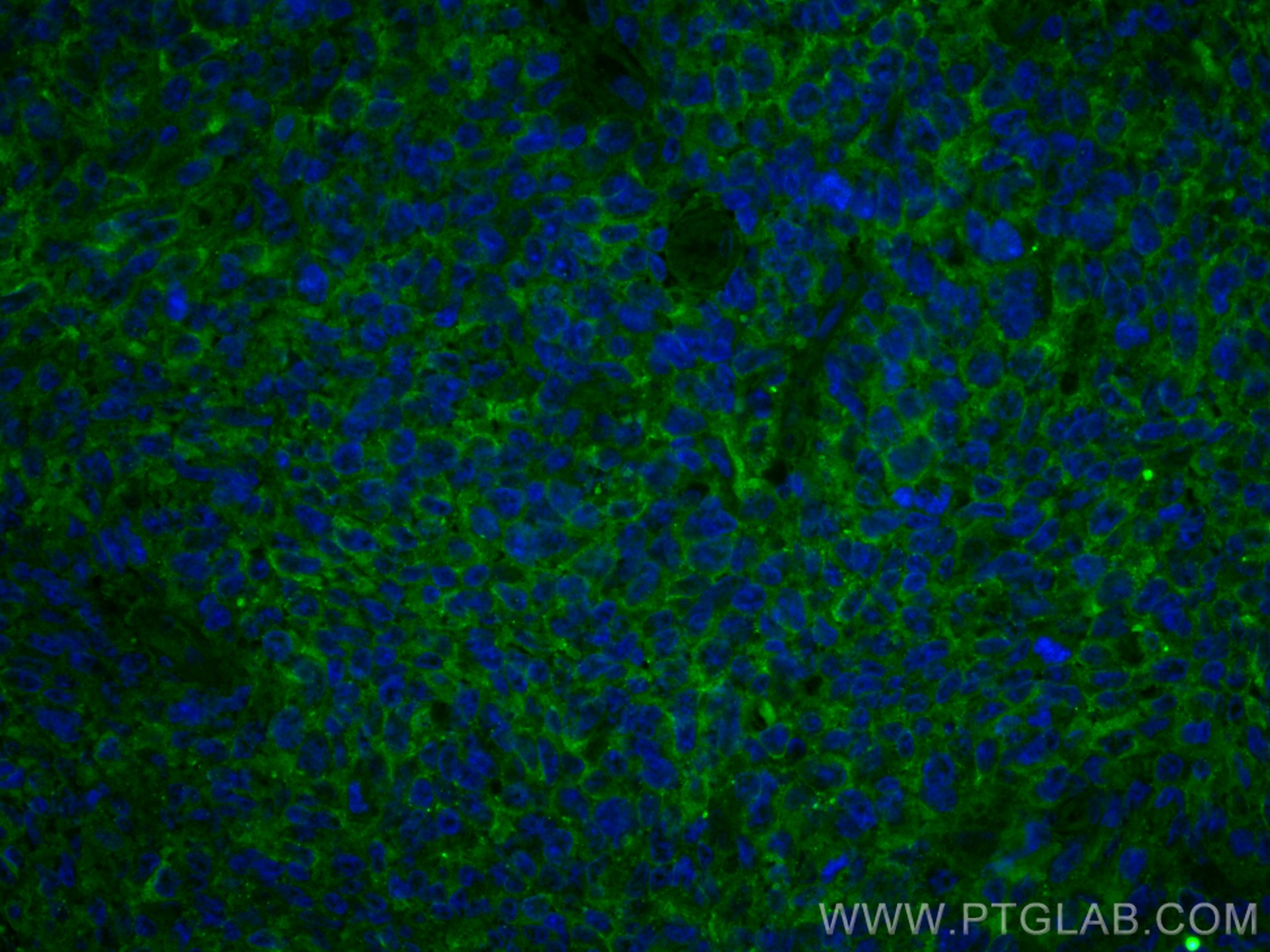 Immunofluorescence (IF) / fluorescent staining of human tonsillitis tissue using CoraLite® Plus 488-conjugated IL-9 Monoclonal anti (CL488-66144)