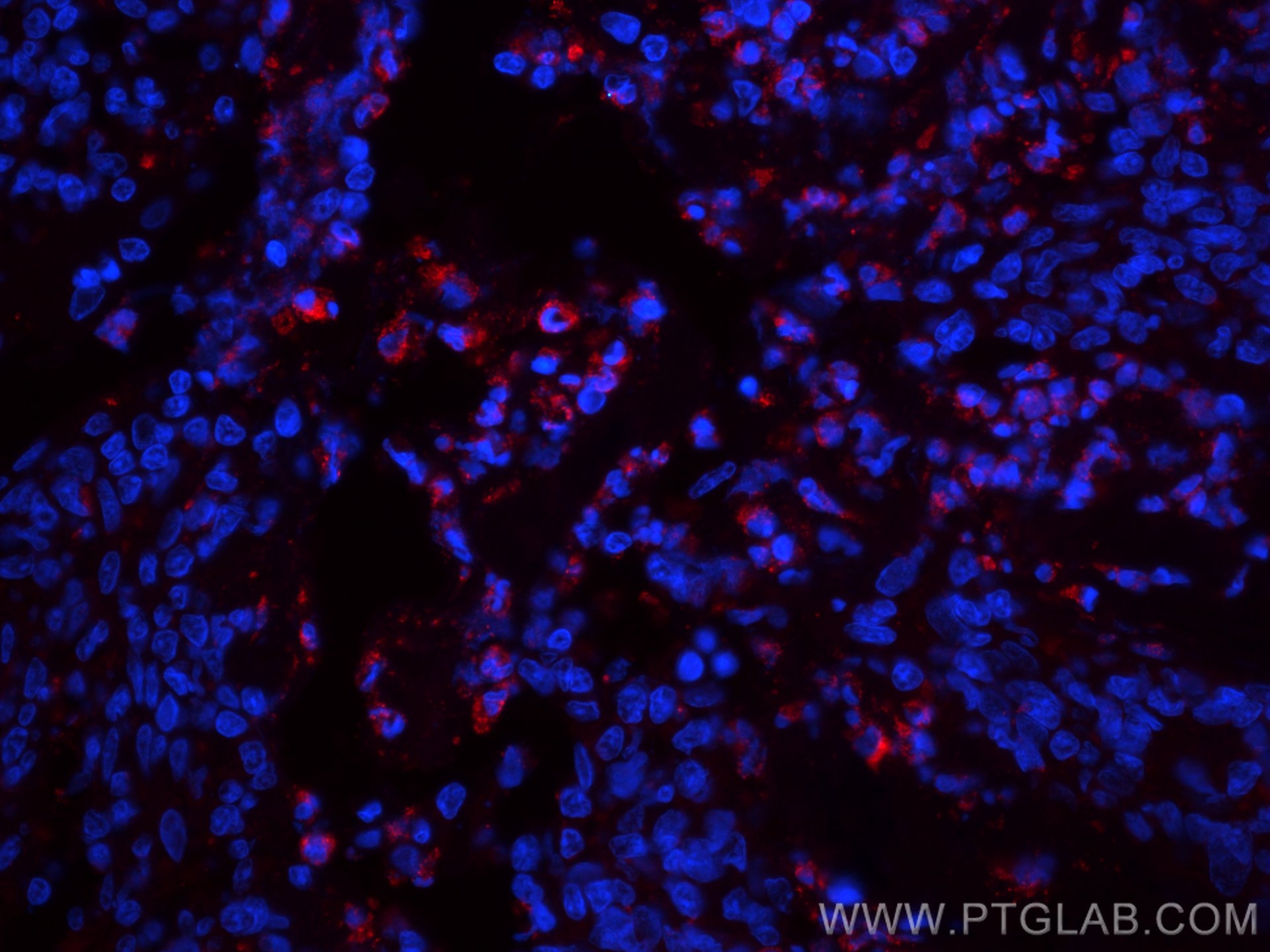 Immunofluorescence (IF) / fluorescent staining of human tonsillitis tissue using CoraLite®594-conjugated IL-9 Monoclonal antibody (CL594-66144)