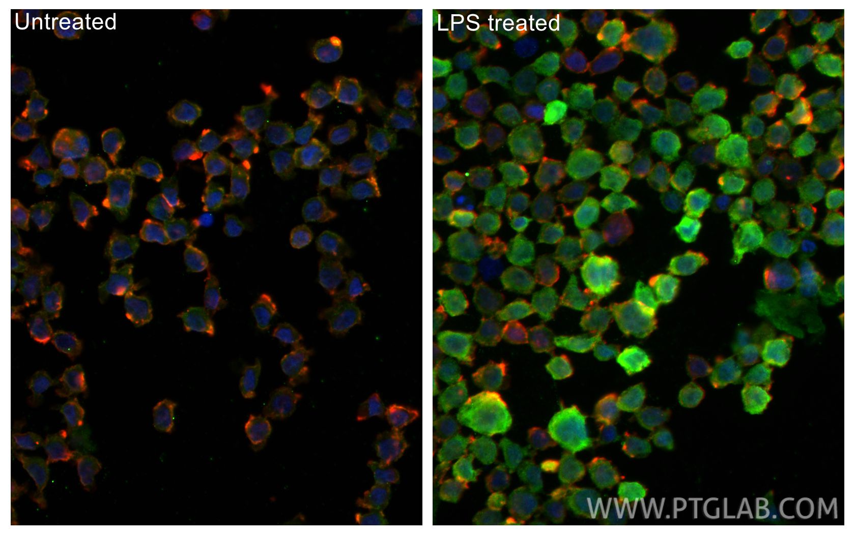 Immunofluorescence (IF) / fluorescent staining of THP-1 cells using IL-1 beta Monoclonal antibody (66737-1-Ig)