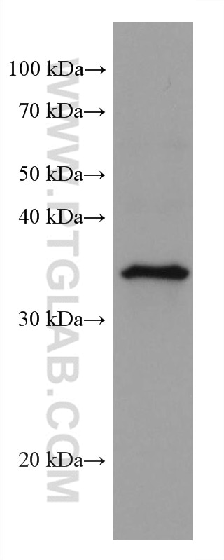 Western Blot (WB) analysis of A431 cells using IL-1 Beta Monoclonal antibody (66737-1-Ig)