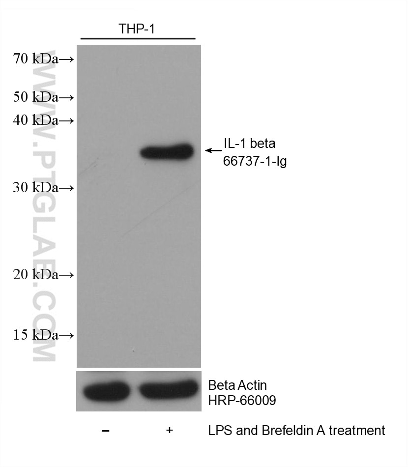 Western Blot (WB) analysis of various lysates using IL-1 beta Monoclonal antibody (66737-1-Ig)