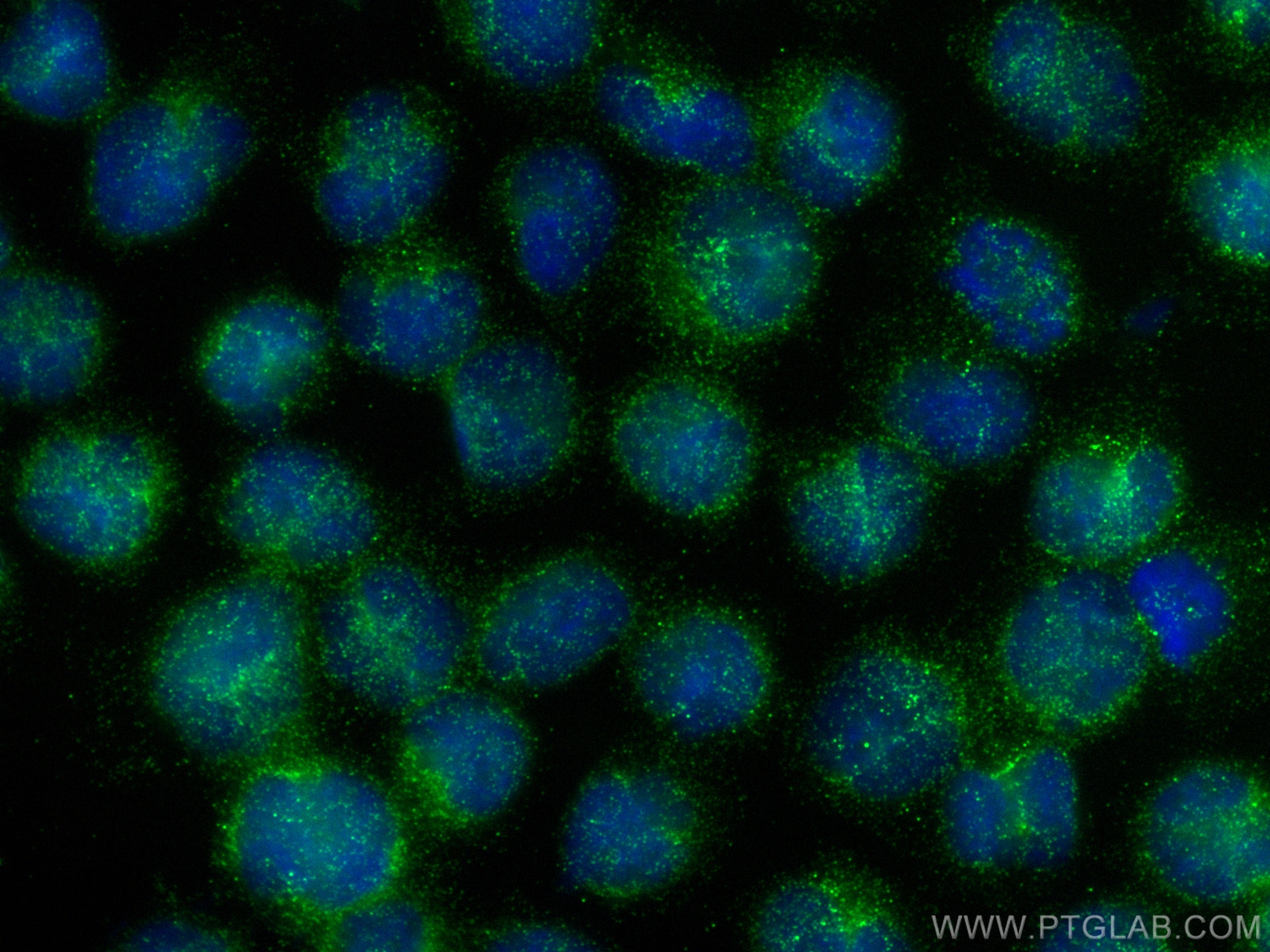 Immunofluorescence (IF) / fluorescent staining of MOLT-4 cells using IL-10 Monoclonal antibody (60269-1-Ig)
