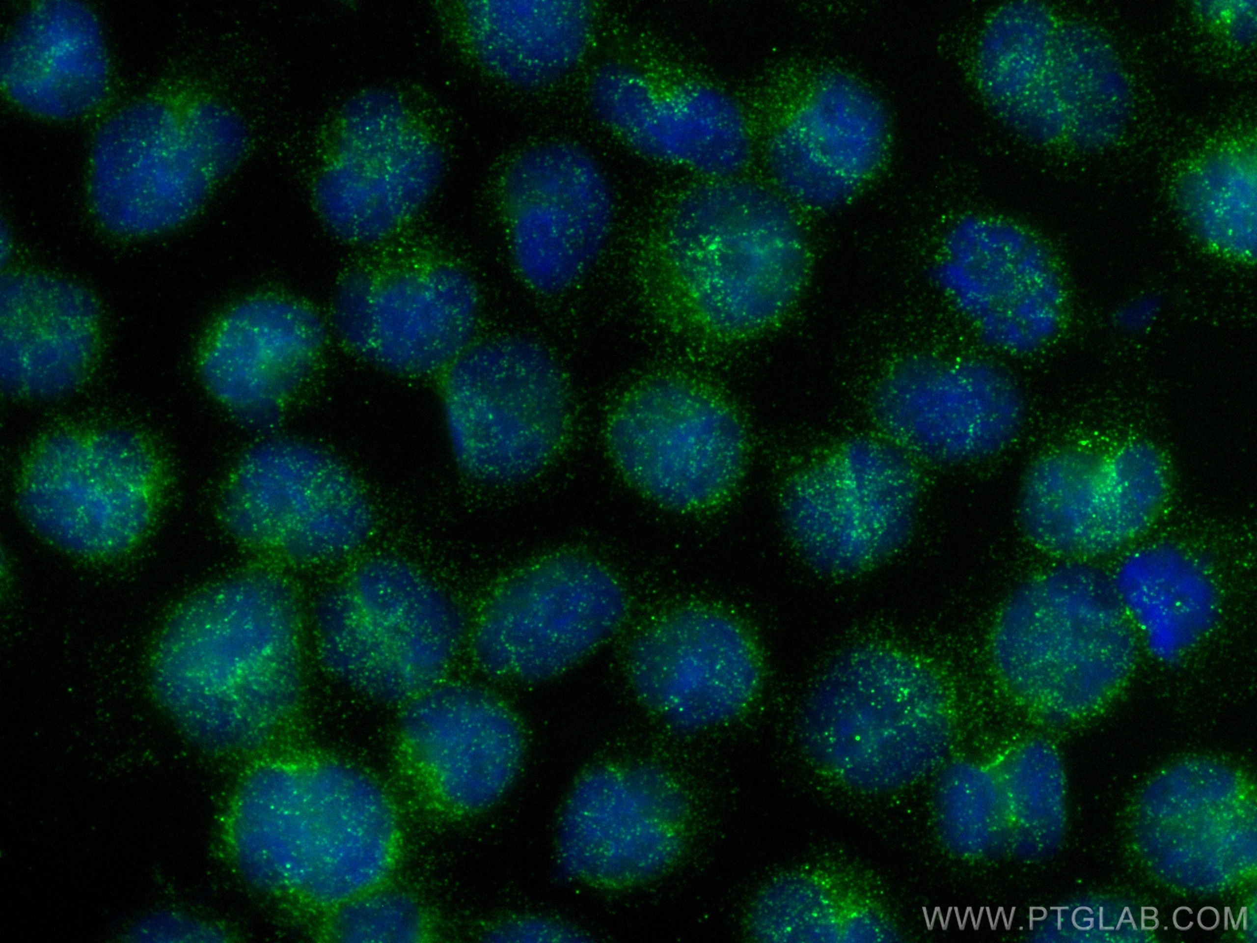 IF Staining of MOLT-4 using 60269-1-Ig