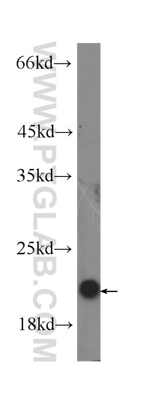 Western Blot (WB) analysis of Recombinant protein using IL-10 Monoclonal antibody (60269-1-Ig)