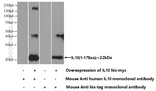 IL-10 Monoclonal antibody