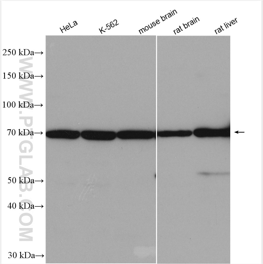 Western Blot (WB) analysis of various lysates using IL-10RA Polyclonal antibody (13356-1-AP)