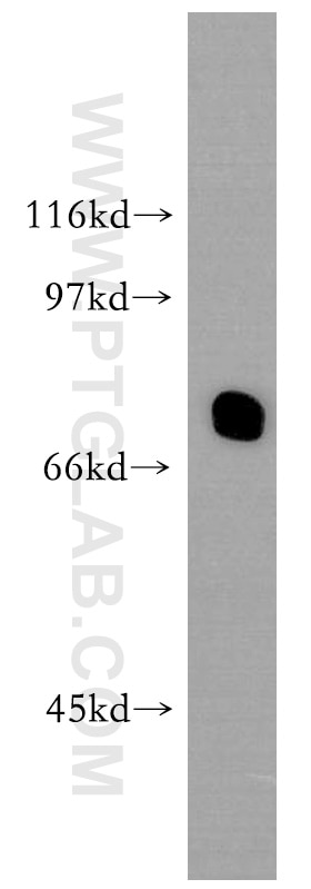 Western Blot (WB) analysis of human placenta tissue using IL-10RA Polyclonal antibody (13356-1-AP)