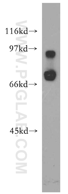 Western Blot (WB) analysis of human liver tissue using IL-10RA Polyclonal antibody (13356-1-AP)