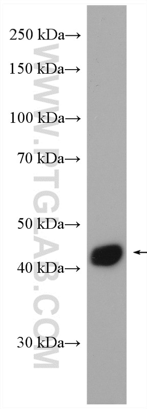 Western Blot (WB) analysis of rat skeletal muscle tissue using IL-10RB Polyclonal antibody (15102-1-AP)