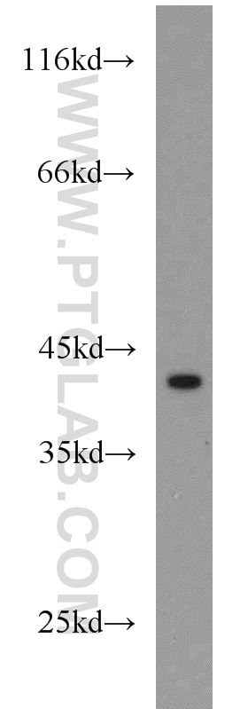 Western Blot (WB) analysis of Jurkat cells using IL-10RB Polyclonal antibody (15102-1-AP)