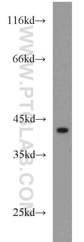Western Blot (WB) analysis of Jurkat cells using IL-10RB Polyclonal antibody (15102-1-AP)