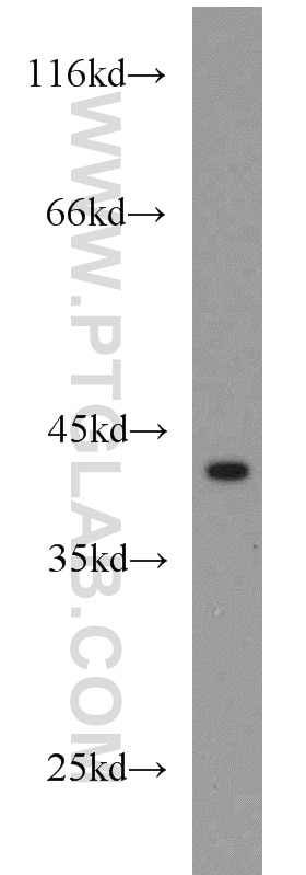 WB analysis of Jurkat using 15102-1-AP