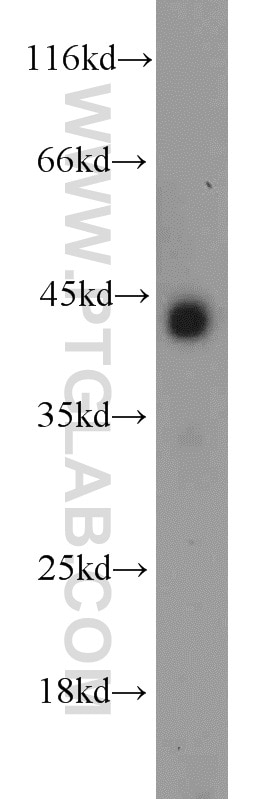 Western Blot (WB) analysis of mouse skeletal muscle tissue using IL-10RB Polyclonal antibody (15102-1-AP)