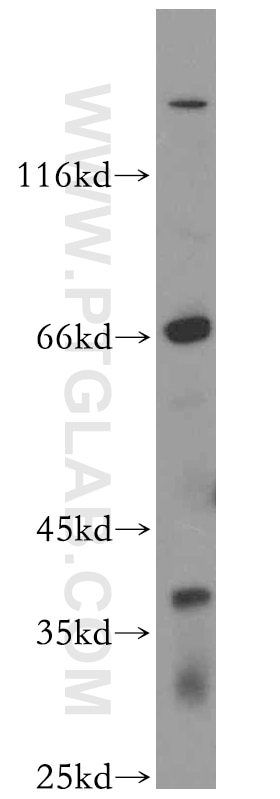 Western Blot (WB) analysis of K-562 cells using IL-10RB Polyclonal antibody (19387-1-AP)