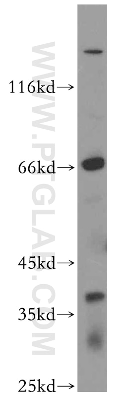 WB analysis of K-562 using 19387-1-AP