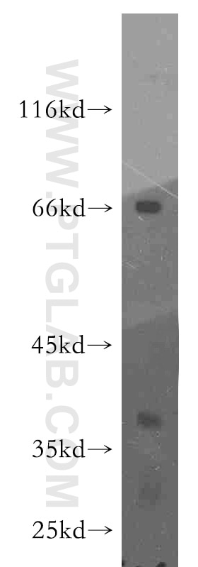 Western Blot (WB) analysis of HeLa cells using IL-10RB Polyclonal antibody (19387-1-AP)