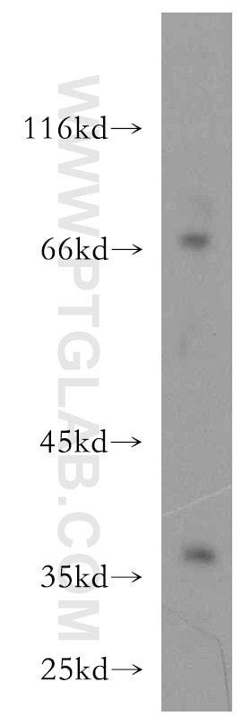 Western Blot (WB) analysis of Jurkat cells using IL-10RB Polyclonal antibody (19387-1-AP)