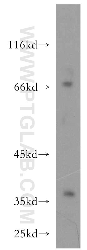 Western Blot (WB) analysis of Jurkat cells using IL-10RB Polyclonal antibody (19387-1-AP)