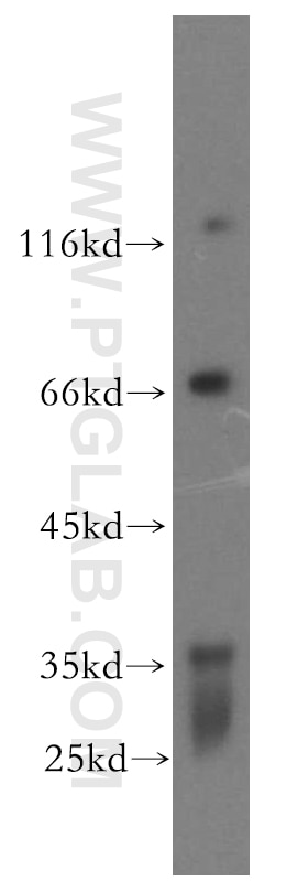 Western Blot (WB) analysis of Jurkat cells using IL-10RB Polyclonal antibody (19387-1-AP)