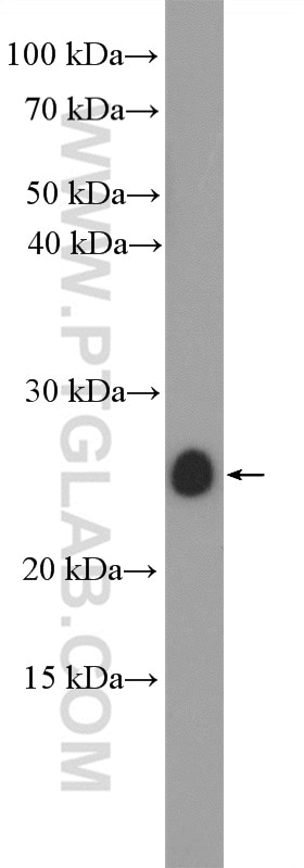Western Blot (WB) analysis of human plasma using IL-11 Polyclonal antibody (55169-1-AP)