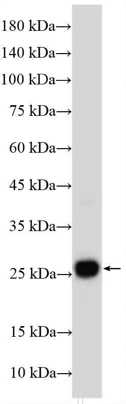 Western Blot (WB) analysis of various lysates using IL-11 Polyclonal antibody (55169-1-AP)