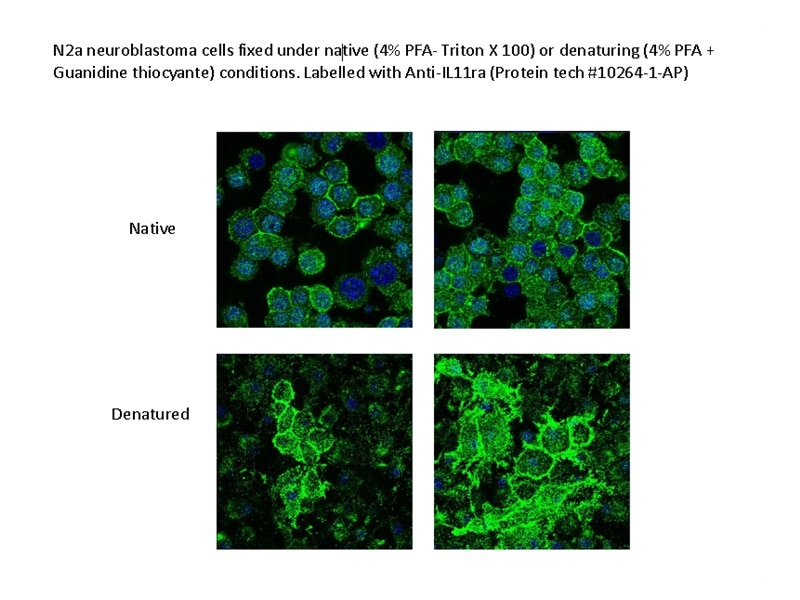 Immunofluorescence (IF) / fluorescent staining of N2a cells using IL-11RA Polyclonal antibody (10264-1-AP)