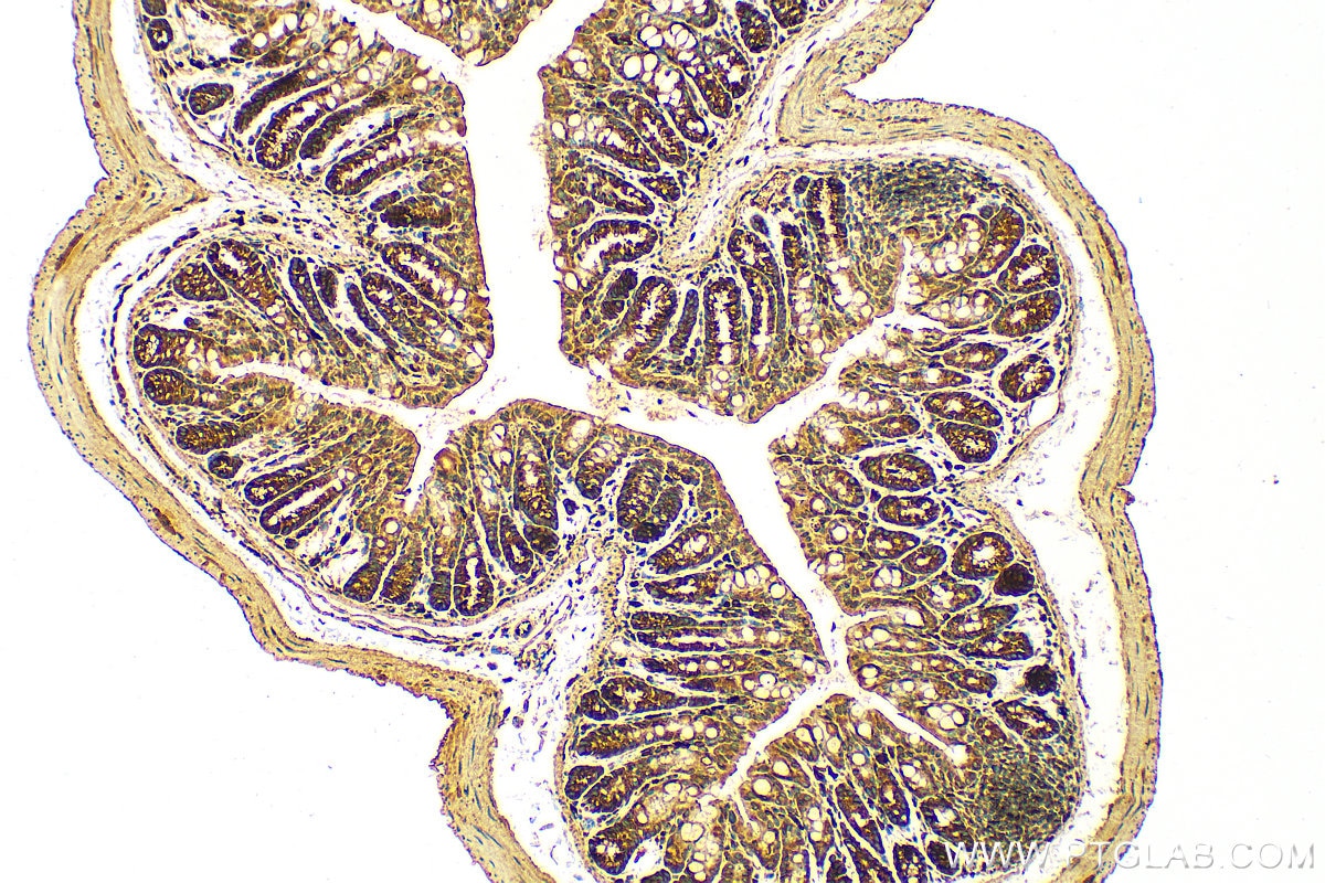 Immunohistochemistry (IHC) staining of mouse colon tissue using IL-11RA Polyclonal antibody (10264-1-AP)