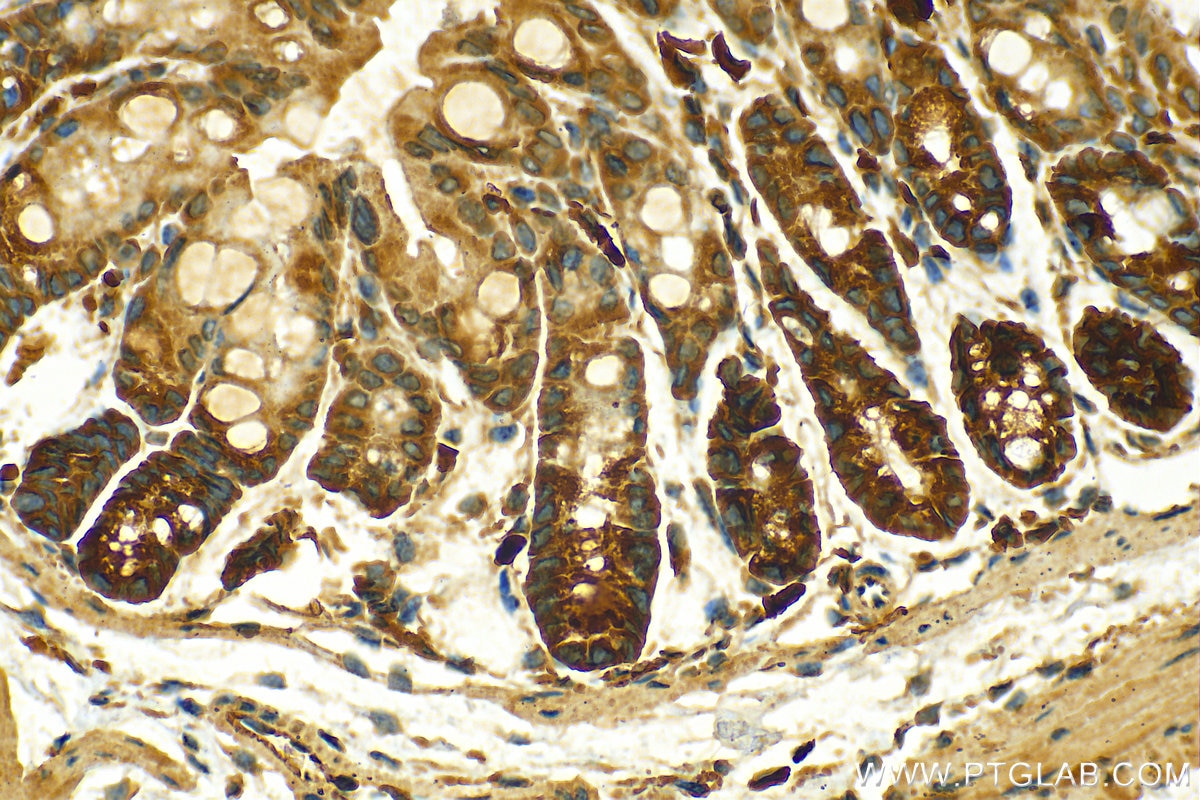 Immunohistochemistry (IHC) staining of mouse colon tissue using IL-11RA Polyclonal antibody (10264-1-AP)