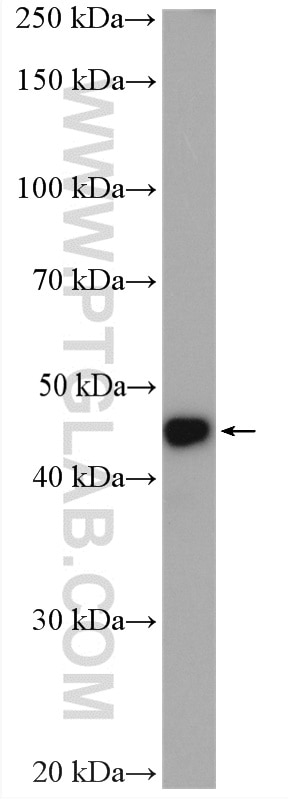 Western Blot (WB) analysis of mouse colon tissue using IL-11RA Polyclonal antibody (10264-1-AP)