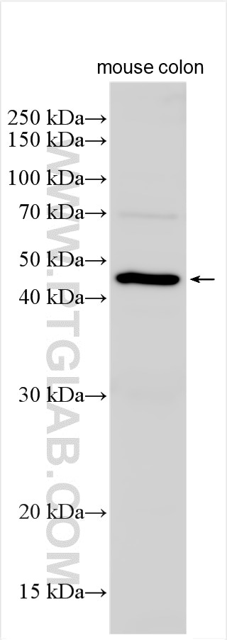 Western Blot (WB) analysis of various lysates using IL-11RA Polyclonal antibody (10264-1-AP)