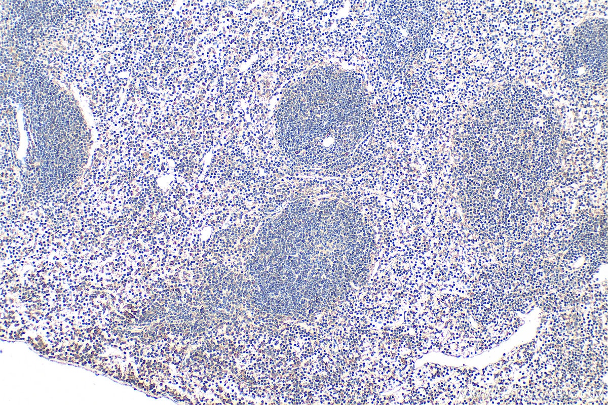 Immunohistochemistry (IHC) staining of mouse spleen tissue using IL-12 p70 Polyclonal antibody (30756-1-AP)