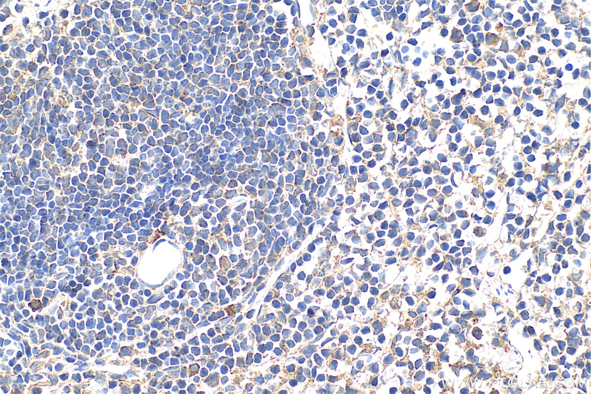 Immunohistochemistry (IHC) staining of mouse spleen tissue using IL-12 p70 Polyclonal antibody (30756-1-AP)