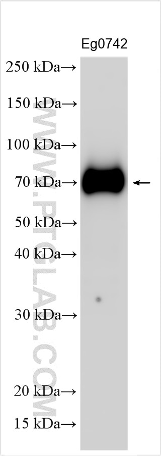 Western Blot (WB) analysis of various lysates using IL-12 p70 Polyclonal antibody (30756-1-AP)