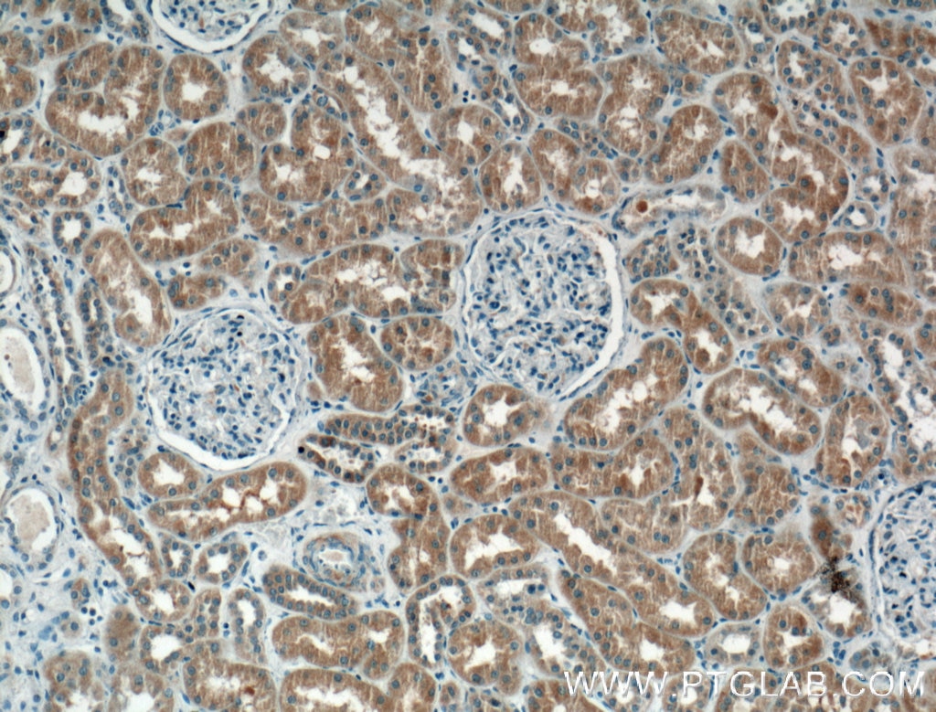 Immunohistochemistry (IHC) staining of human kidney tissue using IL-12A Monoclonal antibody (60324-1-Ig)